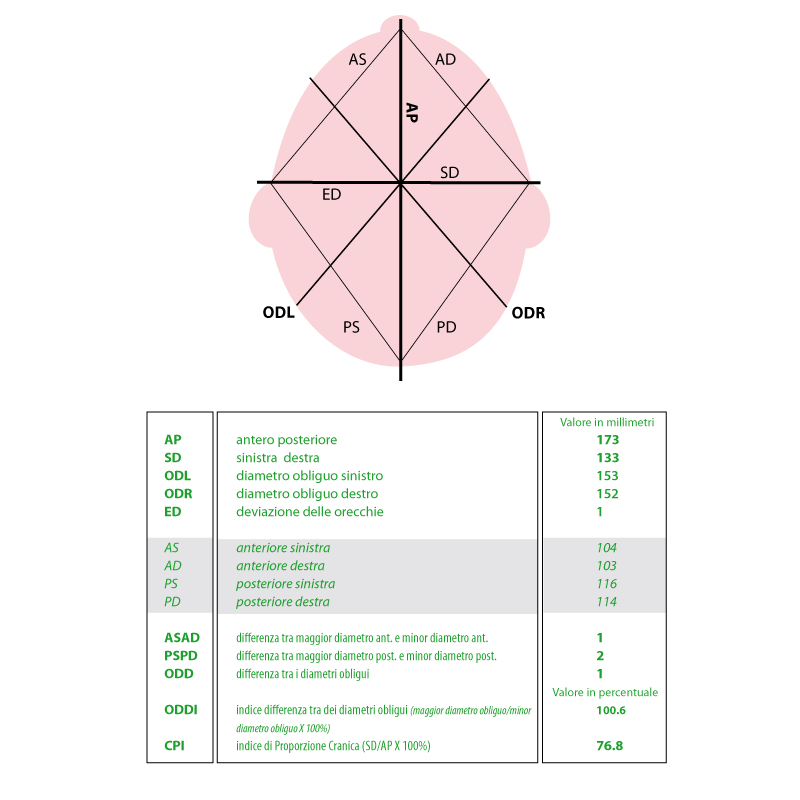 grafico